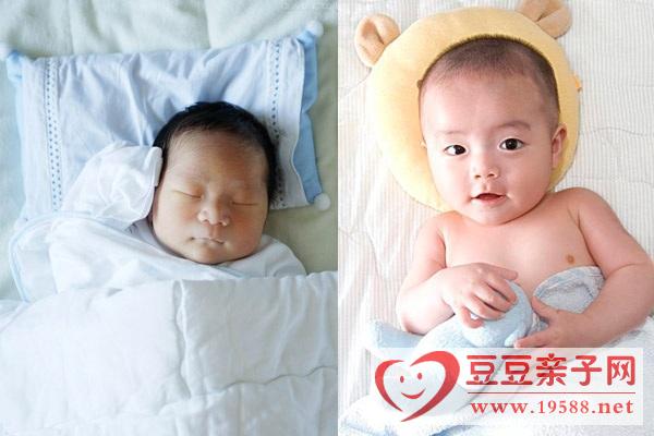 睡姿对宝宝头型起决定性作用，矫正宝宝头型方法