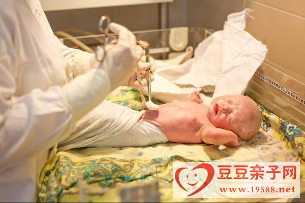 新生儿脐部护理注意清洁和干燥